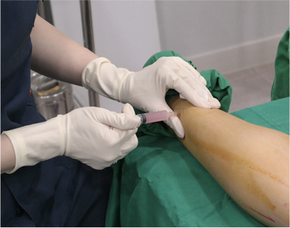 procedure