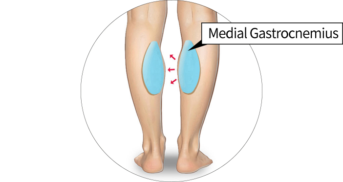 Calf