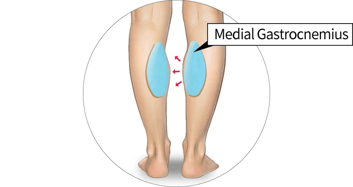 Calf