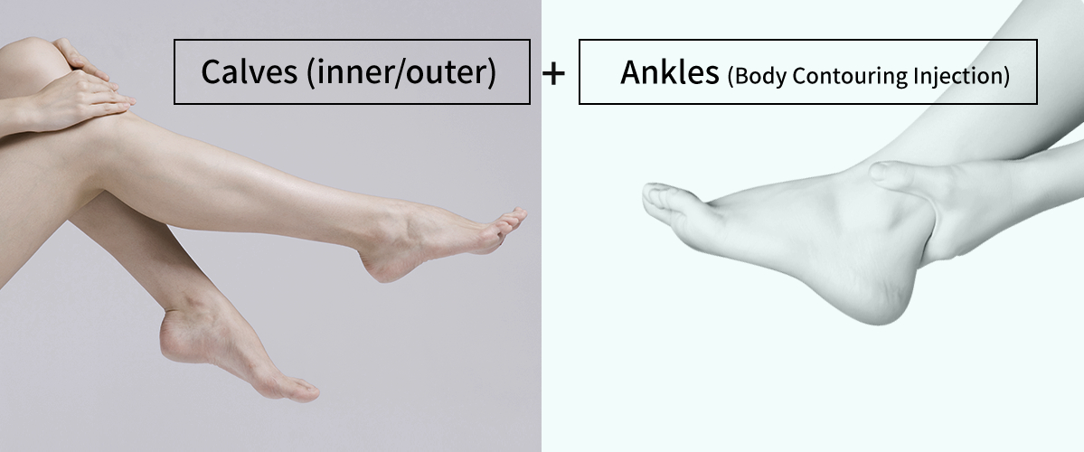 Calf Reduction