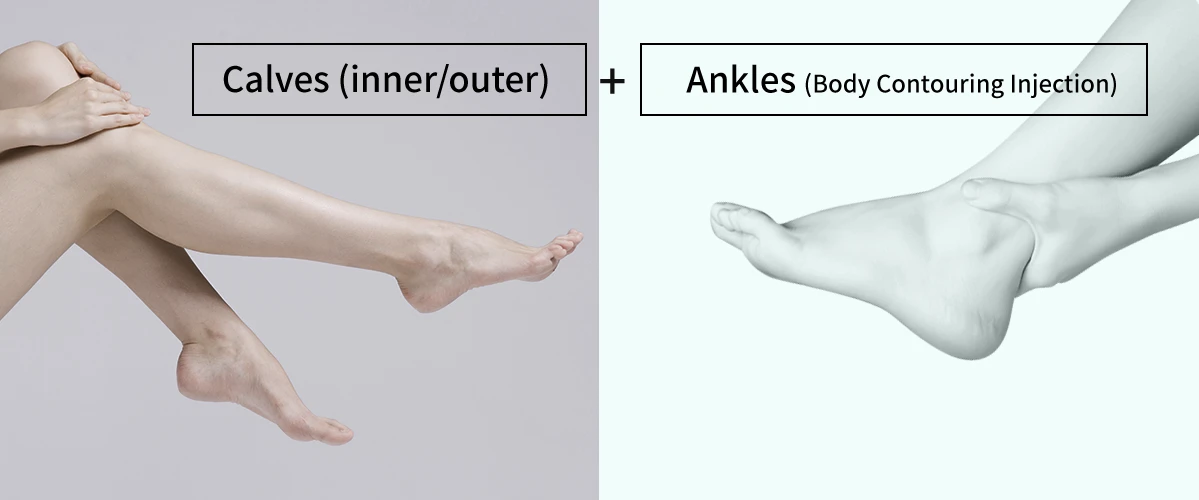 Calf Reduction