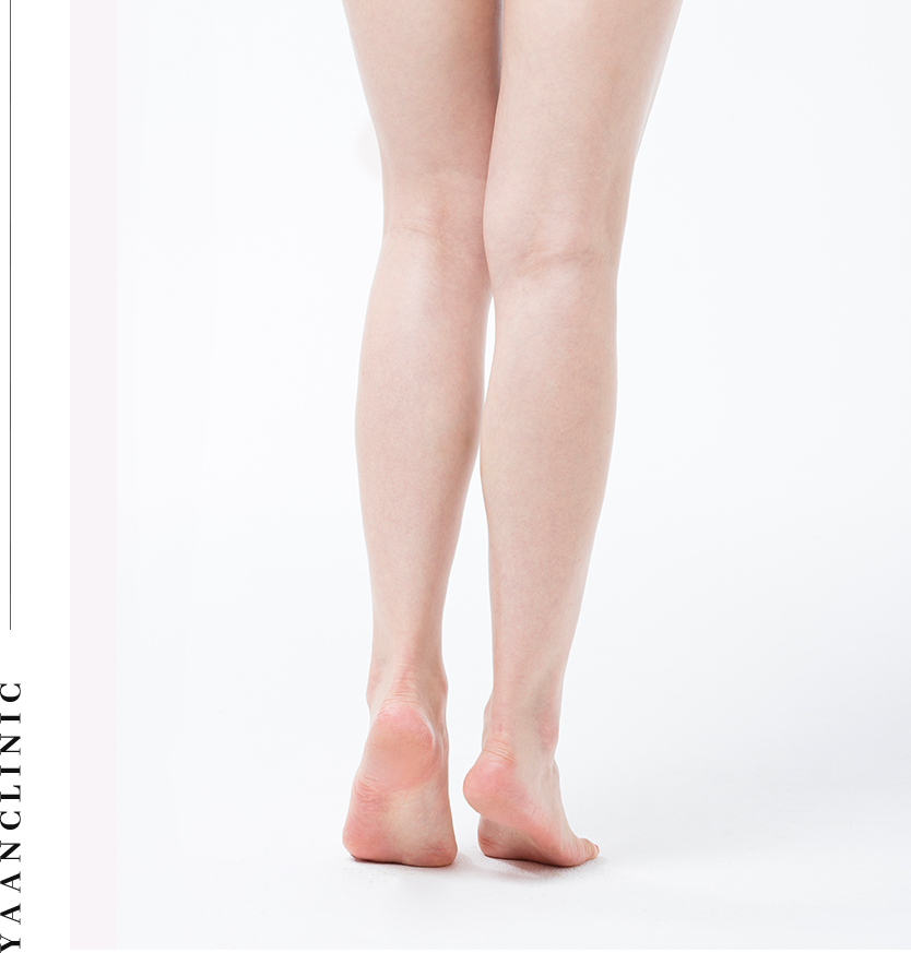 calf