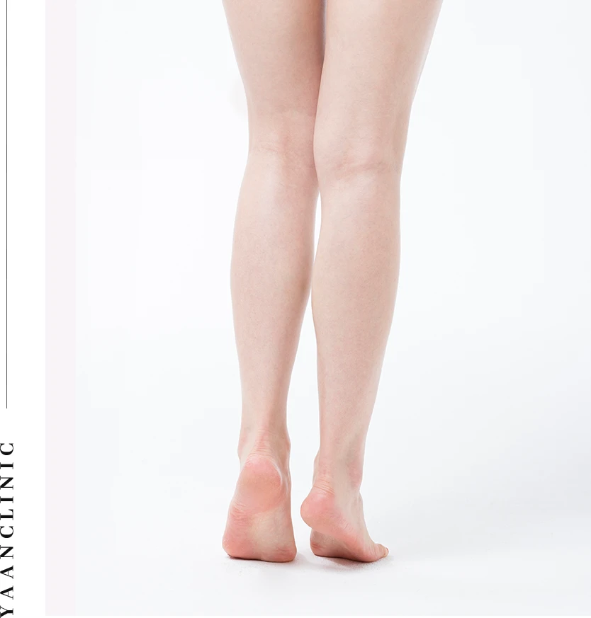 calf