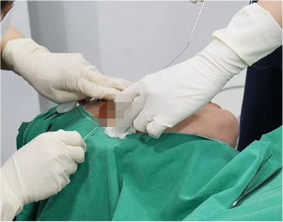 procedure