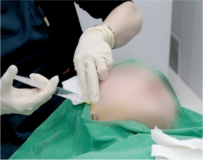 procedure
