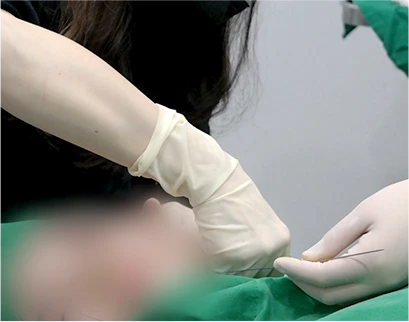procedure