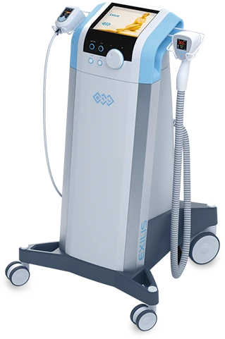 Exilis Laser