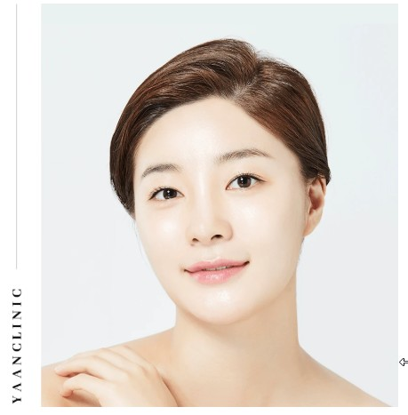 ulthera prime korea before and after jawline contour improvement