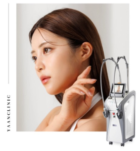 Onda face lifting before and after results in Seoul Korea