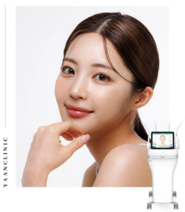 Potenza skin treatment for acne scars and enlarged pores Korea