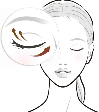 Total Tip สำหรับการรักษารอบดวงตา - Thermage FLX