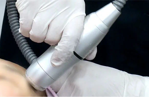 HIFU Lifting - Thermage FLX ที่ Yaan Clinic ย่านคังนัม กรุงโซล