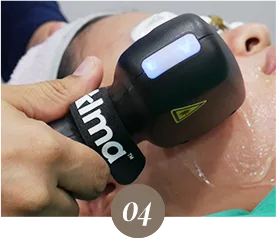 หัตถการ Titanium Lifting หัตถการ Exilis LDM Recovery Therapy WHY? - Dual Titanium Lifting