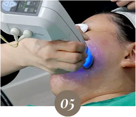 หัตถการ Exilis LDM Recovery Therapy WHY? - Dual Titanium Lifting