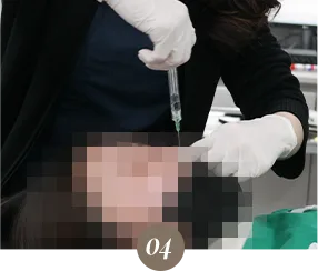 ภาพบรรยากาศคลินิกในขั้นตอนฟิลเลอร์ที่ Yaan Clinic