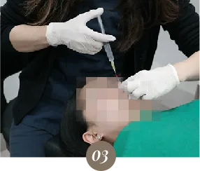 ภาพบรรยากาศคลินิกในขั้นตอนฟิลเลอร์ที่ Yaan Clinic