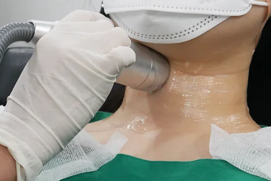 颈纹激光｜Neck Line Filler（Yaan Clinic 江南·首尔）