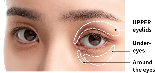 ฟิลเลอร์ใต้ตาและเปลือกตา — Under-Eye and Eyelid Filler ที่ Yaan Clinic กังนัม โซล