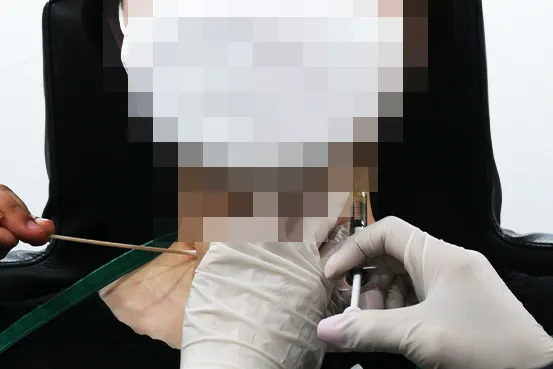 颈纹填充｜Yaan Clinic（江南·首尔）