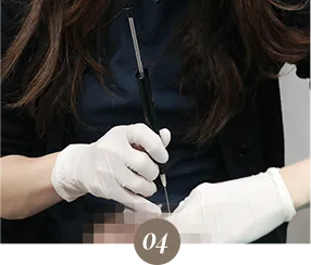 填充与埋线隆鼻流程的诊所实拍：同样 15 分钟，效果不同