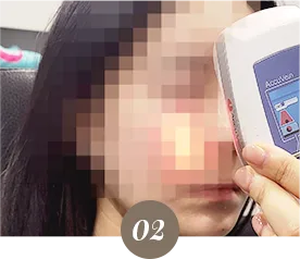 下眼睑与上眼睑填充流程的诊所实拍：自然的双眼需要不一样的做法