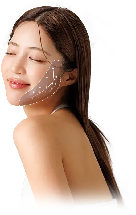 ผลการจัดเรียงคอลลาเจนใหม่ที่อยู่ได้ยาวนาน - Onda Lifting ที่ Yaan Clinic ย่านกังนัม กรุงโซล