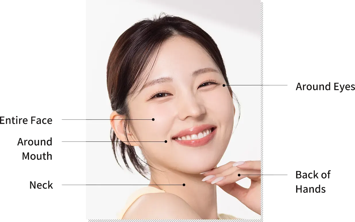 บริเวณที่ทำ Rejuran Healer ได้ ที่ Yaan Clinic ย่านกังนัม กรุงโซล