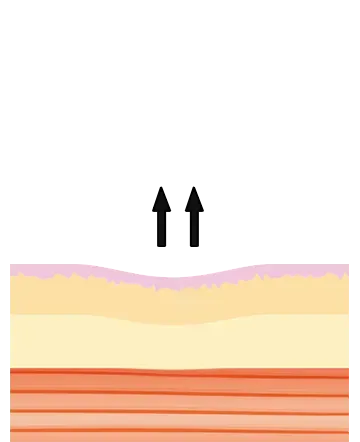 step2
