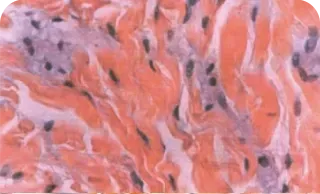 由内而生的容积 — 首尔江南 Yaan Clinic 的 Sculptra