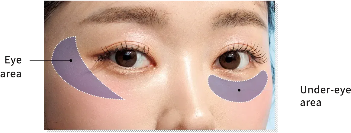 บริเวณที่ทำ Juvelook Eye ได้ ที่ Yaan Clinic ย่านกังนัม กรุงโซล