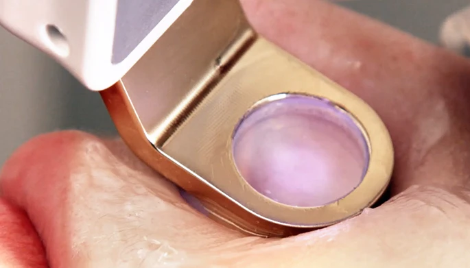 V Laser Sapphire Cooling System ― Personal Brightening