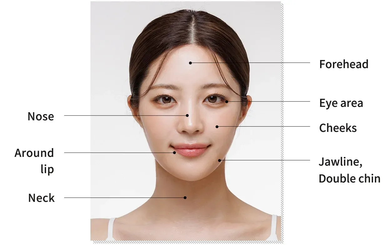 Potenza Microneedling ที่ Yaan Clinic ย่านกังนัม กรุงโซล