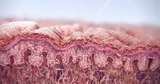 随着时间推移,可期待自然的容积提升 — Sculptra