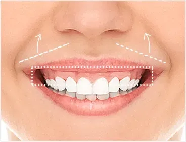 院内照片:首尔江南 Yaan Clinic 的露龈笑 Botox 施术