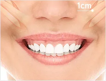 院内照片:首尔江南 Yaan Clinic 的露龈笑 Botox 施术