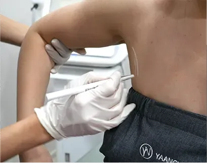 procedure