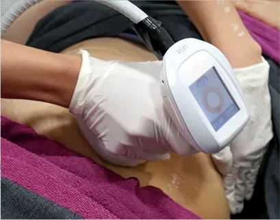 procedure