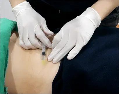 procedure