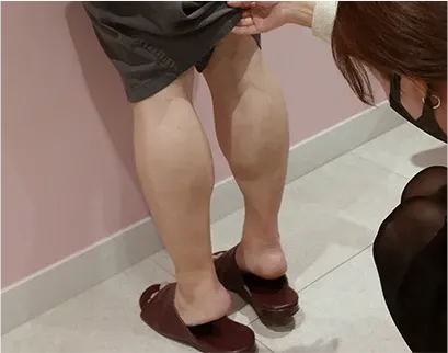 ภาพในคลินิก: หัตถการลดน่องที่ Yaan Clinic ย่านกังนัม กรุงโซล