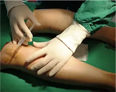 ภาพในคลินิก: หัตถการลดน่องที่ Yaan Clinic ย่านกังนัม กรุงโซล