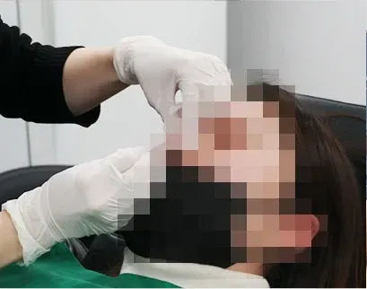 ภาพในคลินิก: การฉีด Skinplus Hyal ที่ Yaan Clinic ย่านกังนัม กรุงโซล