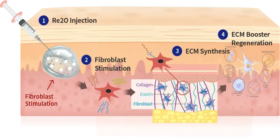 直接补充 ECM — 首尔江南 Yaan Clinic 的 Re2O Cell