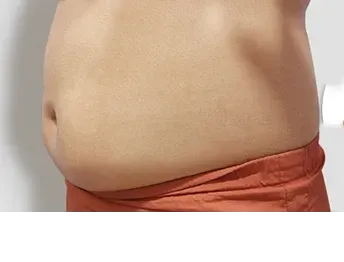 āļāđāļāļāļāļģ: āļāļĩāļāļĨāļāđāļāļĄāļąāļ Di-Fat āļāļĢāļīāđāļ§āļāļāđāļāđāļāļ - āđāļāļŠāļāļĩāđ 1