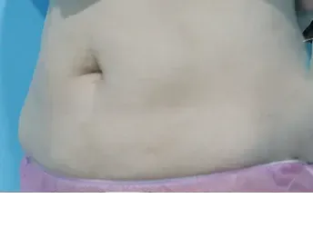 āļāđāļāļāļāļģ: āļāļĩāļāļĨāļāđāļāļĄāļąāļ Di-Fat āļāļĢāļīāđāļ§āļāļāđāļāđāļāļ - āđāļāļŠāļāļĩāđ 3