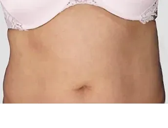 āļāđāļāļāļāļģ: āļāļĩāļāļĨāļāđāļāļĄāļąāļ Di-Fat āļāļĢāļīāđāļ§āļāļāđāļāđāļāļ - āđāļāļŠāļāļĩāđ 4