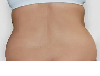 āļāđāļāļāļāļģ: āļāļĩāļāļĨāļāđāļāļĄāļąāļ Di-Fat āļāļĢāļīāđāļ§āļāļāđāļāđāļāļ - āđāļāļŠāļāļĩāđ 5