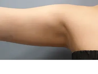 āļŦāļĨāļąāļāļāļģ 3 āđāļāļ·āļāļ: āļāļĩāļāļĨāļāđāļāļĄāļąāļ Di-Fat āļāļĢāļīāđāļ§āļāļāđāļāđāļāļ - āđāļāļŠāļāļĩāđ 7