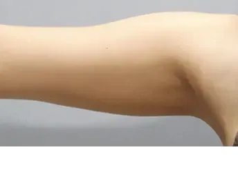 āļāđāļāļāļāļģ: āļāļĩāļāļĨāļāđāļāļĄāļąāļ Di-Fat āļāļĢāļīāđāļ§āļāļāđāļāđāļāļ - āđāļāļŠāļāļĩāđ 10