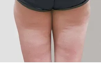 āļāđāļāļāļāļģ: āļāļĩāļāļĨāļāđāļāļĄāļąāļ Di-Fat āļāļĢāļīāđāļ§āļāļāđāļāđāļāļ - āđāļāļŠāļāļĩāđ 13