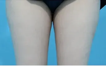 āļāđāļāļāļāļģ: āļāļĩāļāļĨāļāđāļāļĄāļąāļ Di-Fat āļāļĢāļīāđāļ§āļāļāđāļāđāļāļ - āđāļāļŠāļāļĩāđ 17